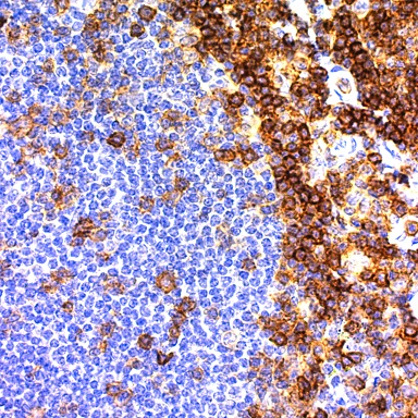 CD43 (T-Cell); Clone DF-T1 (Ready-To-Use)